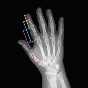 Nature’s intelligence and the ability to learn are reflected in the structure of the human hand. The continuous geometrical proportion between the phalanges is the famous Golden Section or Phi ratio, which allows the hand to open and close in the most elegant way, by integrating the part with the whole.